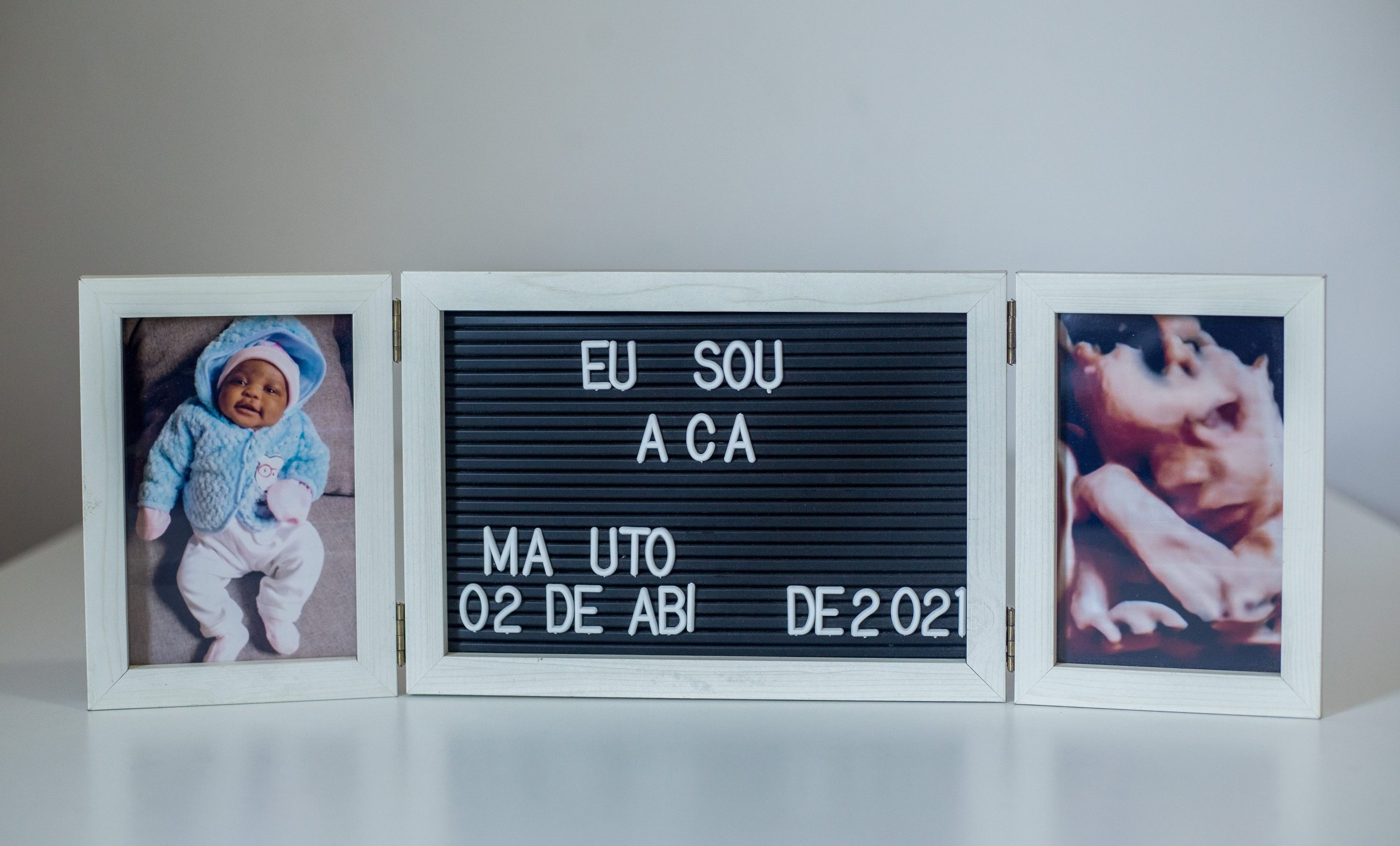 Ecografia Obstetrica 4D